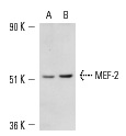 MEF-2 (N-18): sc-13917. Western blot analysis of MEF-2 expression in rat (A) and mouse (B) brain tissue extracts.