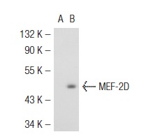 MEF-2 (N-18): sc-13917. Western blot analysis of MEF-2D expression in non-transfected: sc-117752 (A) and mouse MEF-2D transfected: sc-121589 (B) 293T whole cell lysates.
