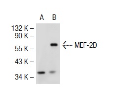 MEF-2 (N-18): sc-13917. Western blot analysis of MEF-2D expression in non-transfected: sc-117752 (A) and human MEF-2D transfected: sc-116416 (B) 293T whole cell lysates.