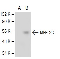 MEF-2 (N-18): sc-13917. Western blot analysis of MEF-2C expression in non-transfected: sc-117752 (A) and mouse MEF-2C transfected: sc-121587 (B) 293T whole cell lysates.