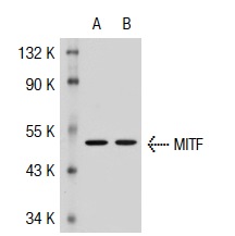 MITF (D5): sc-56726. Western blot analysis of MITF expression in non-transfected: sc-117752 (A) and human MITF transfected: sc-117019 (B) 293T whole cell lysates.