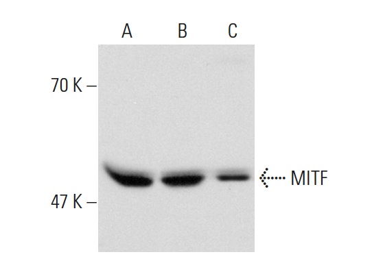 MITF (D5): sc-56726. Western blot analysis of MITF expression in Jurkat (A), A-431 (B) and HeLa (C) nuclear extracts.