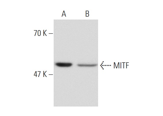 MITF (D5): sc-56726. Western blot analysis of MITF expression in HeLa (A) and A549 (B) nuclear extracts.