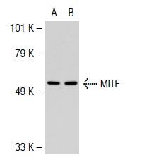MITF (3F276): sc-71588. Western blot analysis of MITF expression in non-transfected: sc-117752 (A) and human MITF transfected: sc-117019 (B) 293T whole cell lysates.