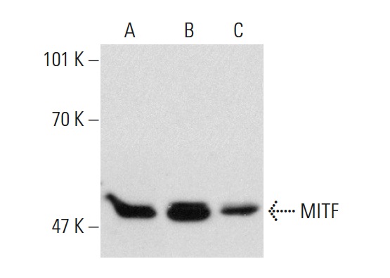 MITF (3F276): sc-71588. Western blot analysis of MITF expression in Jurkat (A), A-431 (B) and HeLa (C) nuclear extracts.
