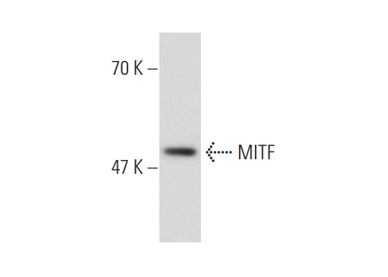MITF (3F276): sc-71588. Western blot analysis of MITF expression in HeLa nuclear extract.