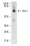 Dio-1 (B-9): sc-25264. Western blot analysis of Dio-1 expression in RAW 264.7 nuclear extract.
