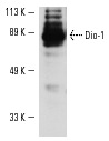 Dio-1 (B-9): sc-25264. Western blot analysis of Dio-1 expression in RAW 264.7 nuclear extract.