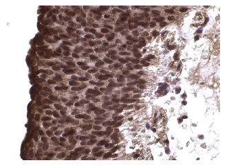 mSin3A (AK-11): sc-767. Immunoperoxidase staining of formalin fixed, paraffin-embedded human urinary bladder tissue showing nuclear staining of urothelial cells.