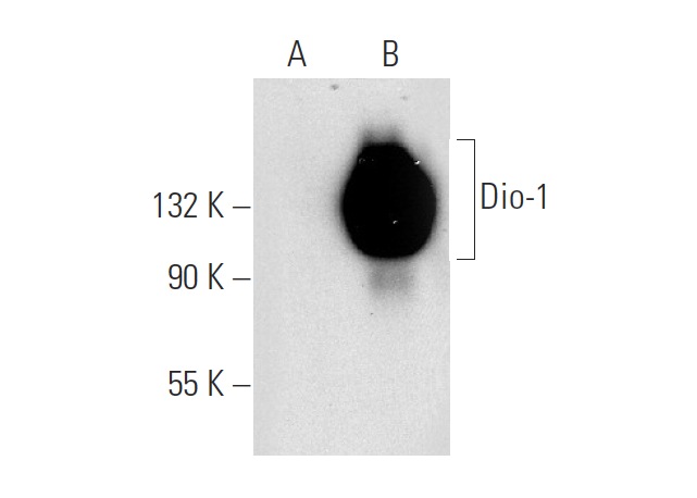 Dio-1 (B-9): sc-25264. Western blot analysis of Dio-1 expression in non-transfected: sc-117752 (A) and human Dio-1 transfected: sc-176595 (B) 293T whole cell lysates.