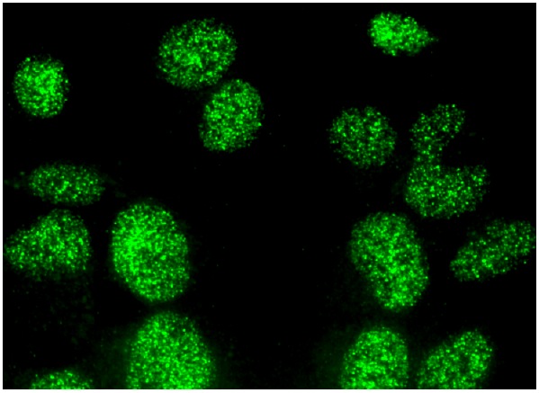 mSin3A (G-11): sc-5299. Immunofluorescence staining of formalin-fixed HepG2 cells showing nuclear localization.