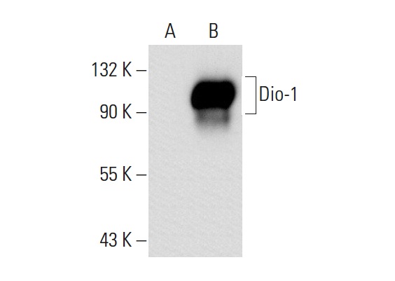 Dio-1 (B-9): sc-25264. Western blot analysis of Dio-1 expression in non-transfected: sc-117752 (A) and human Dio-1 transfected: sc-159185 (B) 293T whole cell lysates.