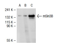 mSin3B (H-4): sc-13145. Western blot analysis of mSin3B expression in non-transfected: sc-117752 (A) and mouse mSin3B transfected: sc-121801 (B) 293T whole cell lysates and HeLa nuclear extract (C).