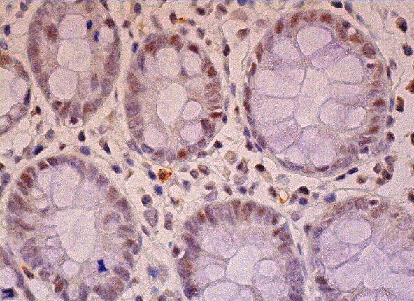 Dio-1 (B-9): sc-25264. Immunoperoxidase staining of formalin fixed, paraffin-embedded human colon tissue showing nuclear staining of glandular cells and endothelial cells.