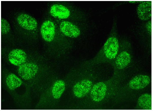 Dio-1 (B-9): sc-25264. Immunofluorescence staining of formalin-fixed HepG2 cells showing nuclear localization.