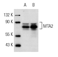 MTA2 (C-20): sc-9447. Western blot analysis of MTA2 expression in ZR-75-1 (A) and SW480 (B) whole cell lysates.