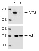MTA2 siRNA (h): sc-35983. Western blot analysis of MTA2 expression in non-transfected control (A) and MTA2 siRNA transfected (B) HeLa cells. Blot probed with MTA2 (C-20): sc-9447. Actin (I-19): sc-1616 used as specificity and loading control.