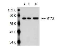 MTA2 (H-170): sc-28731. Western blot analysis of MTA2 expression in non-transfected 293T: sc-117752 (A), human MTA2 transfected 293T: sc-116480 (B) and ZR-75-1 (C) whole cell lysates.
