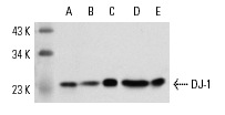 DJ-1 (N-20): sc-27004. Western blot analysis of DJ-1 expression in NIH/3T3 (A), HeLa (B), SK-N-SH (C) whole cell lysates and mouse brain (D) and rat testis (E) tissue extracts.