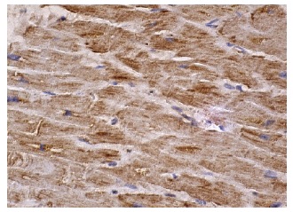 Myf-5 (C-20): sc-302. Immunoperoxidase staining of formalin fixed, paraffin-embedded human heart muscle tissue showing cytoplasmic staining of myocytes.