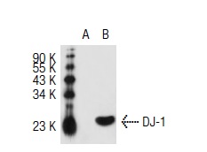 DJ-1 (N-20): sc-27004. Western blot analysis of DJ-1 expression in non-transfected: sc-117752 (A) and mouse DJ-1 transfected: sc-125250 (B) 293T whole cell lysates.