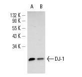 DJ-1 (FL-189): sc-32874. Western blot analysis of DJ-1 expression in BT-20 (A) and HeLa (B) whole cell lysates.