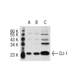 DJ-1 (FL-189): sc-32874. Western blot analysis of DJ-1 expression in non-transfected 293T: sc-117752 (A), mouse DJ-1 transfected 293T: sc-125250 (B) and SK-N-SH (C) whole cell lysates.