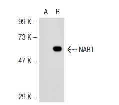 NAB1 (2607C2a): sc-81565. Western blot analysis of NAB1 expression in non-transfected: sc-117752 (A) and mouse NAB1 transfected: sc-121928 (B) 293T whole cell lysates.