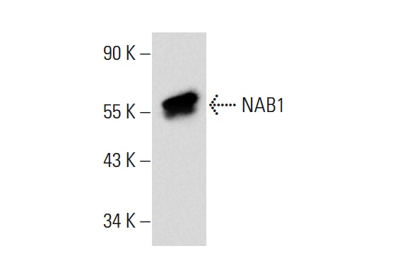 NAB1 (2607C2a): sc-81565. Western blot analysis of NAB1 expression in HeLa whole cell lysate.