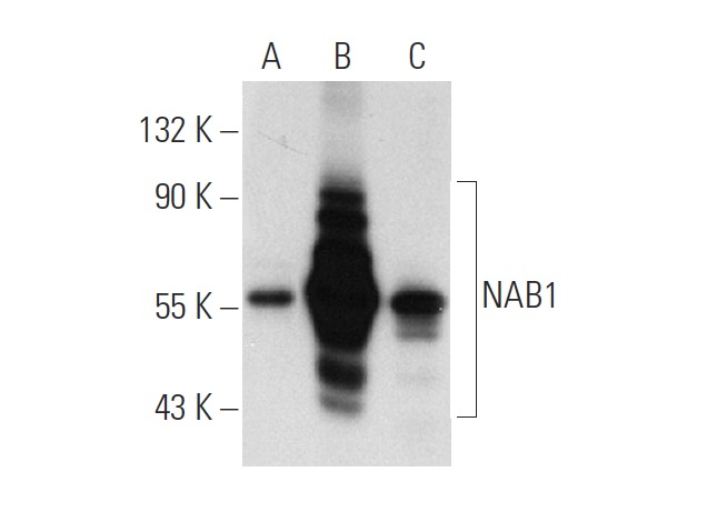 NAB1 (2607C2a): sc-81565. Western blot analysis of NAB1 expression in non-transfected 293T: sc-117752 (A), human NAB1 transfected 293T: sc-115360 (B) and SK-N-MC (C) whole cell lysates.