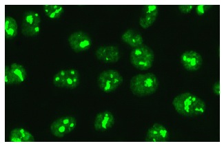 NDH II (H-300): sc-66997. Immunofluorescence staining of methanol-fixed HeLa cells showing nucleolar and nuclear localization.