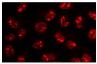 NDH II (H-300): sc-66997. Immunofluorescence staining of methanol-fixed HeLa cells showing nucleolar and nuclear localization.