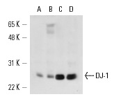 DJ-1 (D-4): sc-55572. Western blot analysis of DJ-1 expression in F9 whole cell lysate (A) and mouse testis (B), rat testis (C) and rat brain (D) tissue extracts.