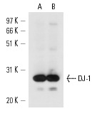 DJ-1 (A-9): sc-55573. Western blot analysis of DJ-1 expression in BT-20 (A) and HeLa (B) whole cell lysates.