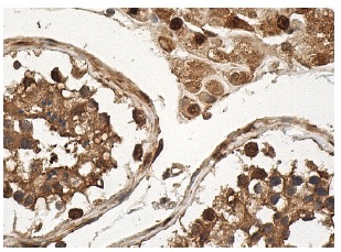 DJ-1 (A-9): sc-55573. Immunoperoxidase staining of formalin fixed, paraffin-embedded human testis tissue showing nuclear and cytoplasmic staining of cells in seminiferous ducts and Leydig cells.