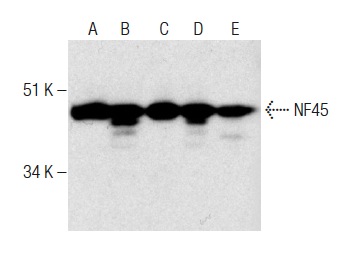 NF45 (G-3): sc-365068. Western blot analysis of NF45 expression in Jurkat (A), HeLa (B), K-562 (C), Hep G2 (D) and NIH/3T3 (E) whole cell lysates.
