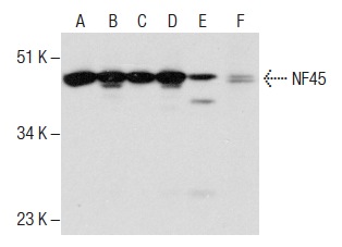 NF45 (G-3): sc-365068. Western blot analysis of NF45 expression in Jurkat (A), HeLa (B), K-562 (C), Hep G2 (D) and NIH/3T3 (E) nuclear extracts and rat spleen tissue extract (F).