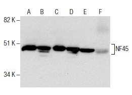 NF45 (H-4): sc-365283. Western blot analysis of NF45 expression in Jurkat (A), HeLa (B), K-562 (C), Hep G2 (D) and NIH/3T3 (E) nuclear extracts and rat spleen tissue extract (F).