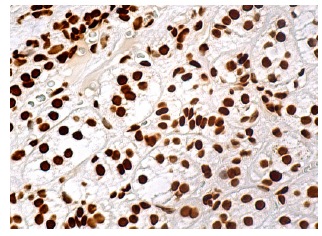 NF45 (A-8): sc-271718. Immunoperoxidase staining of formalin fixed, paraffin-embedded human adrenal gland tissue showing nuclear staining of glandular cells.