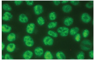 NF90 (21): sc-136197. Immunofluorescence staining of methanol-fixed HeLa cells showing nuclear localization.