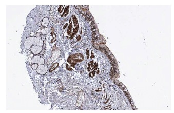 NFATc4 (L-9): sc-32985. Immunoperoxidase staining of formalin fixed, paraffin-embedded human broncus tissue showing nuclear and cytoplasmic staining of respiratory epithelial cells at low magnification. Kindly provided by The Swedish Human Protein Atlas (HPA) program.