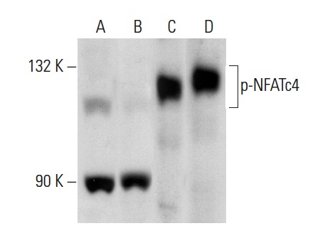 Western blot analysis of NFATc4 phosphorylation in untreated (A, C) and lambda protein phosphatase treated (B, D) Jurkat whole cell lysates. Antibodies tested include p-NFATc4 (Ser 168/170): sc-32630 (A, B) and NFATc4 (H-74): sc-13036 (C, D).