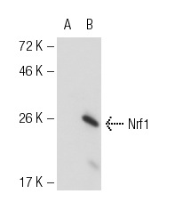 Nrf1 (C-19): sc-721. Western blot analysis of Nrf1 expression in non-transfected: sc-117752 (A) and mouse Nrf1 transfected: sc-125720 (B) 293T whole cell lysates.