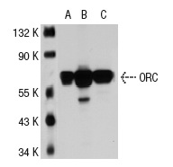 ORC2 (3G6): sc-32734. Western blot analysis of ORC2 expression in non-transfected: sc-117752 (A) and human ORC2 transfected: sc-113531 (B) 293T whole cell lysates.