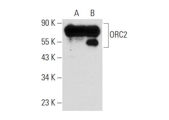 ORC2 (3G6): sc-32734. Western blot analysis of ORC2 expression in non-transfected: sc-117752 (A) and human ORC2 transfected: sc-172764 (B) 293T whole cell lysates.