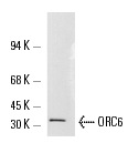 ORC6 (3A4): sc-32735.Western blot analysis of ORC6 expression in mini-EBV transformed A39 whole cell lysate. Kindly provided by A. Schepers at GSF: Nat. Res. Ctr. for Environment and Health, Germany.