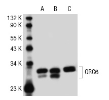 ORC6 (3A4): sc-32735. Western blot analysis of ORC6 expression in U-2 OS (A), SW480 (B) and F9 (C) whole cell lysates.