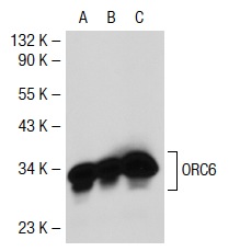 ORC6 (3A4): sc-32735. Western blot analysis of ORC6 expression in non-transfected 293T: sc-117752 (A), human ORC6 transfected 293T: sc-112607 (B) and U-2 OS (C) whole cell lysates.