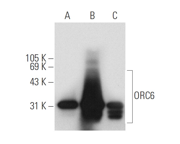 ORC6 (3A4): sc-32735. Western blot analysis of ORC6 expression in non-transfected 293T: sc-117752 (A), human ORC6 transfected 293T: sc-116694 (B) and HeLa (C) whole cell lysates.