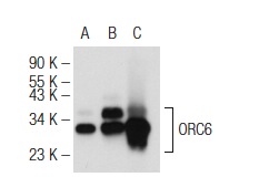 ORC6 (3A4): sc-32735. Western blot analysis of ORC6 expression in non-transfected 293: sc-110760 (A), human ORC6 transfected 293: sc-129354 (B) and HeLa (C) whole cell lysates.
